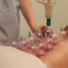 Cupping Body Massage