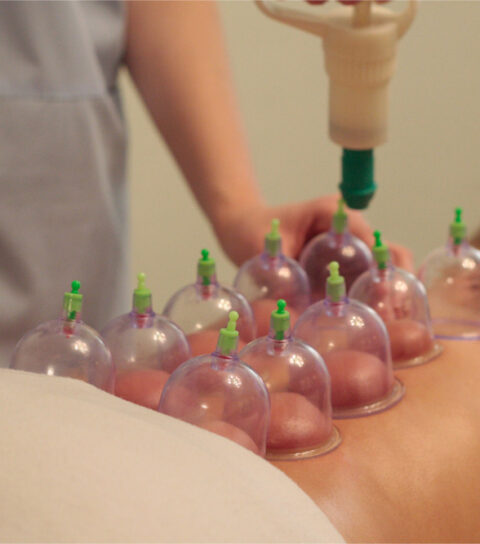 Cupping-Body-Massage