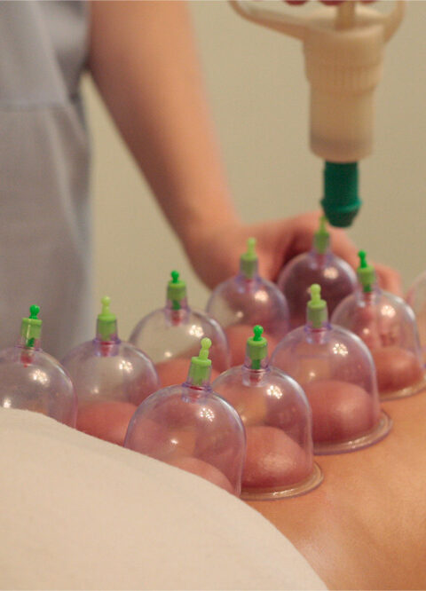 Cupping-Body-Massage