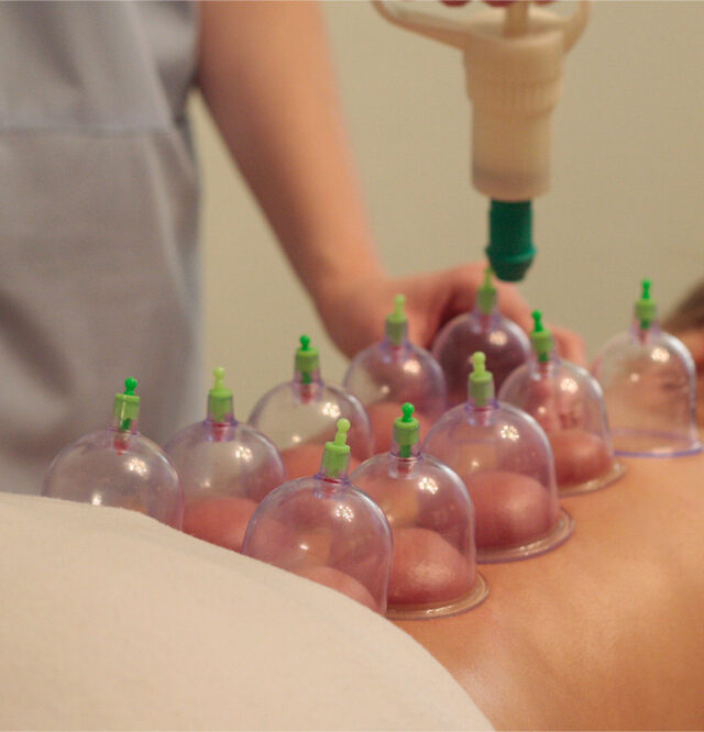 Cupping-Body-Massage